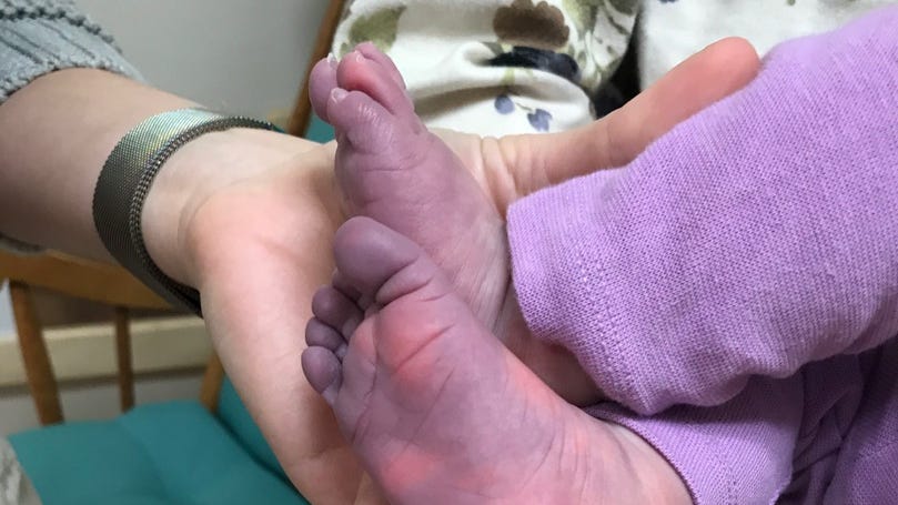 Baby’s Legs And Feet Turning Purple
