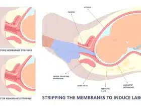 membrane Sweep